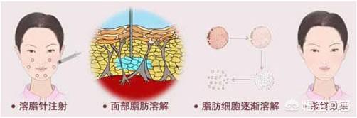 直播欧洲杯怎么瘦脸:欧洲杯直播用什么