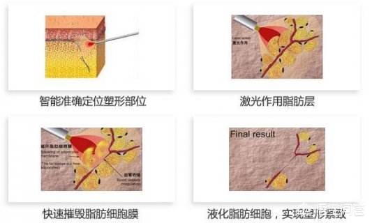 直播欧洲杯怎么瘦脸:欧洲杯直播用什么