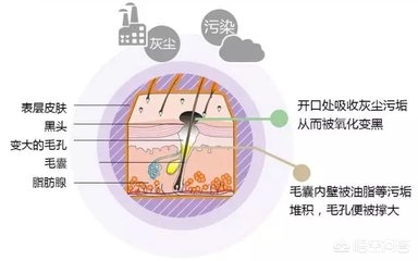 直播欧洲杯怎么去黑头正确:直播的欧洲杯